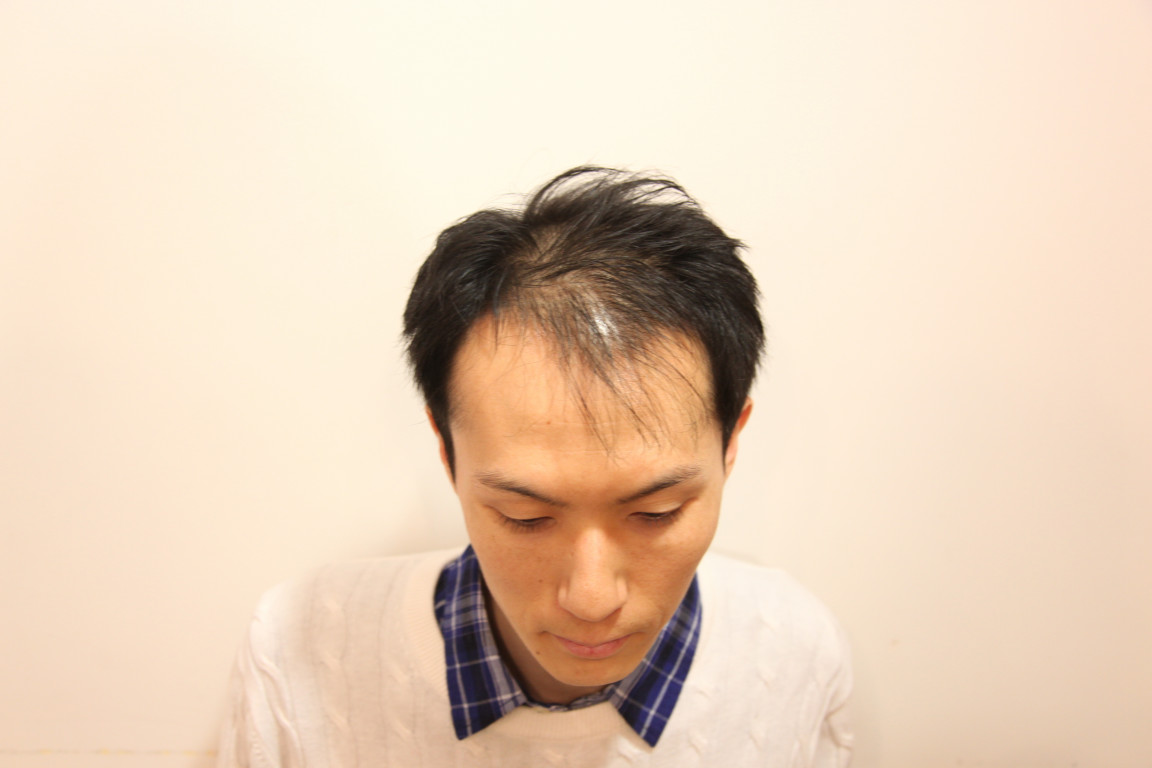 葉巻 異常な 賛美歌 髪型 メンズ 40 代 薄毛 Kazusa7.jp